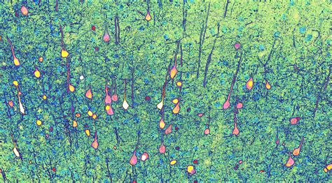 Image result for Neural Development