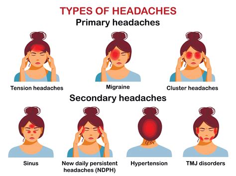 Types Of Headaches And Relief | 13 Types of Headaches and How To Treat ...