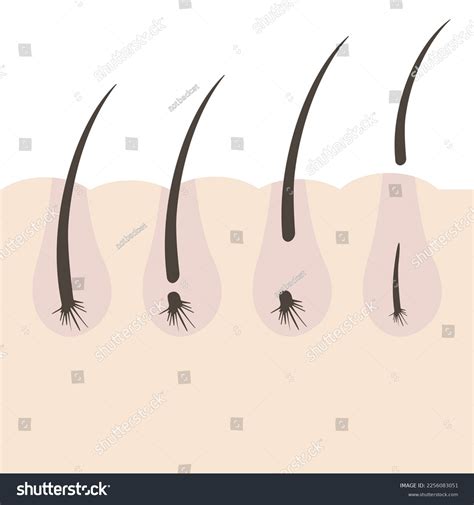 193 Cycle Hair Loss Women Images, Stock Photos & Vectors | Shutterstock