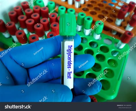 What Color Tube Is Triglycerides at Lavina Flippen blog