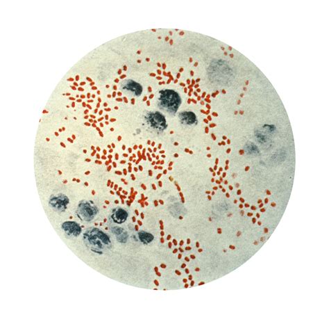 Imagen gratis: microfotografía, Yersinia, Pasteurella, pestis, a veces, el bacilo, pestis
