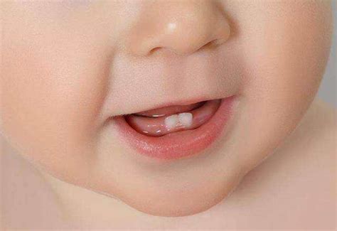 孩子天天刷牙，为什么还会长蛀牙？这3个问题，很多家长都忽视了 - 知乎