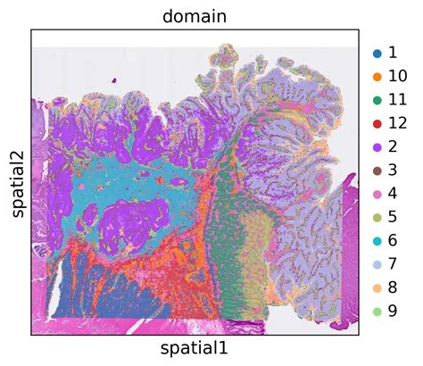 10X空间转录组Visium && HD && Xenium分析全更新_10x visium和hd的区别-CSDN博客