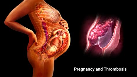 Blood In Uterus While Pregnant Wfumb_01_03_18_08.jpg