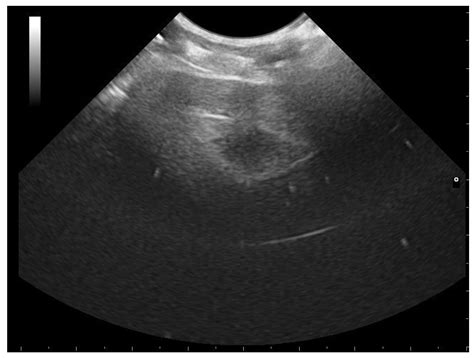 Monitoring of the Reproductive Cycle in Captive-Bred Female Boa ...