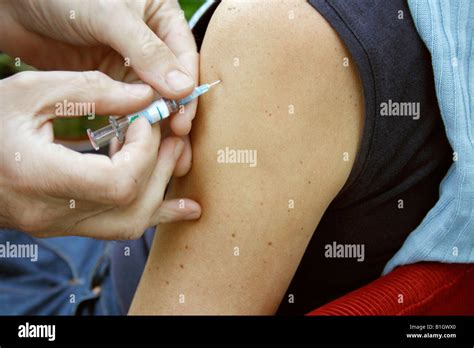 Arm Injection 的图像结果
