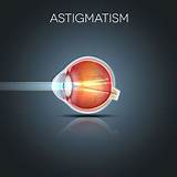 Ten things to Know about Astigmatism - Better Vision Guide