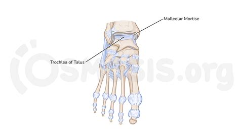 Define Mortise Joint Anatomy at Marianne Holt blog