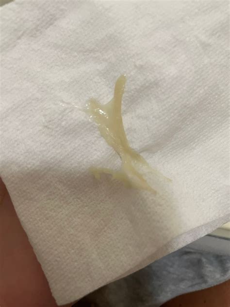 What Color Is The Mucus Plug Discharge