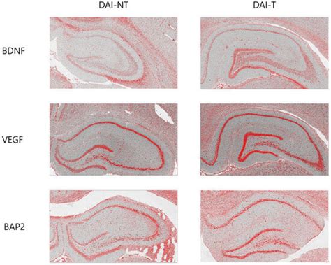 The Effect of Repetitive Transcranial Magnetic Stimulation on Cognition ...