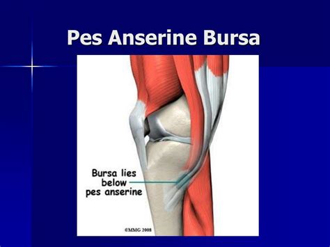 Kuvatulokset haulle pes anserine bursitis