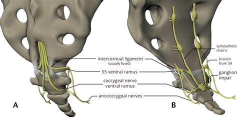 Imaging Coccygeal Trauma and CoccydyniaRadioGraphics