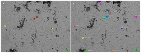 Automated Image Analysis for Detection of Coccidia in Poultry