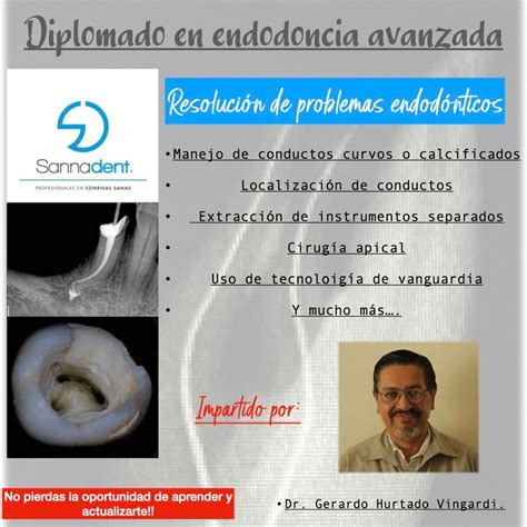 Endodoncia Avanzada, Sannadent Queretaro, 6 February 2024 | AllEvents.in