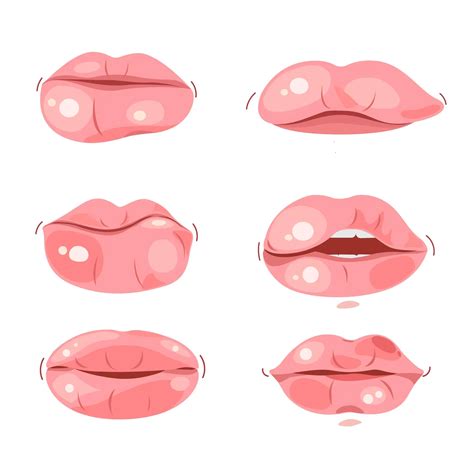 Lip Bumps, Causes, Symptoms, Diagnosis and Treatment Guide