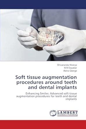 Buy Soft tissue augmentation procedures around teeth and dental ...