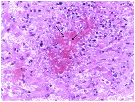 Clinical, Laboratory and Anatomopathological Findings of an Outbreak of ...
