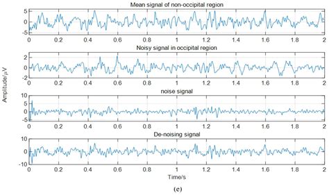 A Methodology for Enhancing SSVEP Features Using Adaptive Filtering ...