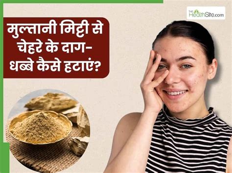 Multani Mitti Se Chehre Ke Daag Dhabbe Kaise Hataye | चेहरे के दाग ...