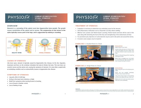 Printable Spinal Stenosis Exercises [PDF] - Physio Ed.
