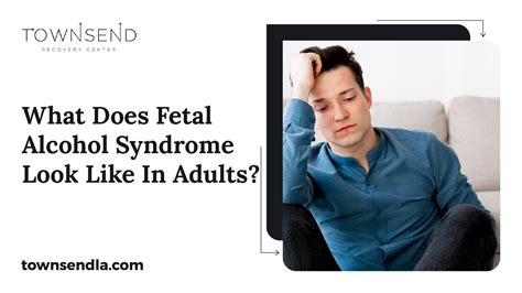 Princess Price Fetal Alcohol Syndrome at Diane Rearick blog