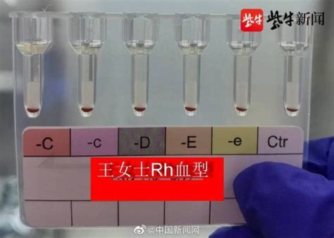 血型，到底是干嘛的？| 果壳 科技有意思