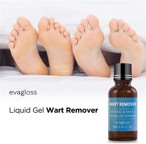 Evagloss Natural Wart Remover - Maximum Strength Liquid Gel for Plantar, Common & Genital Warts ...