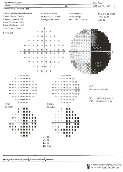 Automated Visual Fields | 9.12 | Westmead Eye Manual