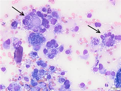 Histiocytic sarcoma in miniature schnauzers: 30 cases - Purzycka - 2020 ...