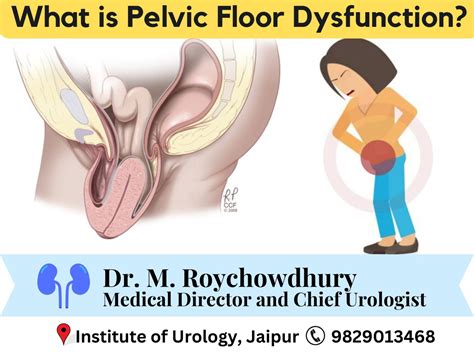 Overactive bladder (OAB) - Institute of Urology
