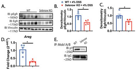 Selenoprotein W Ameliorates Experimental Colitis and Promotes ...