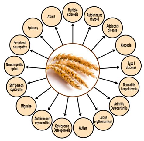 The Role of Exposomes in the Pathophysiology of Autoimmune Diseases I ...