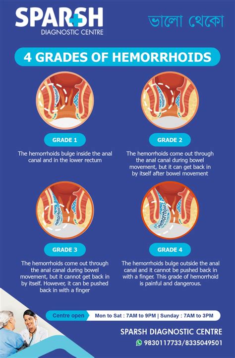 Understanding Hemorrhoid Grades - Sparsh Diagnostic Center