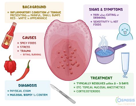 Transient Lingual Papillitis Lie Bumps on Tongue | Osmosis