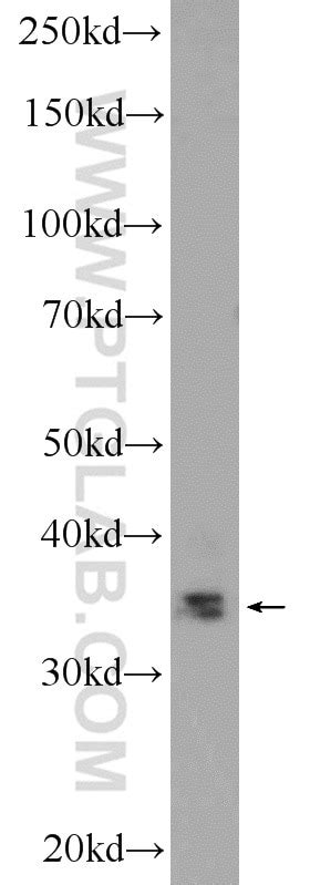 SLMAP antibody (25220-1-AP) | Proteintech