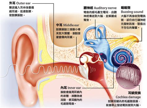 耳鸣的声音使人感觉快疯了，但它不是一种病：耳鸣的警号，你听见了吗?