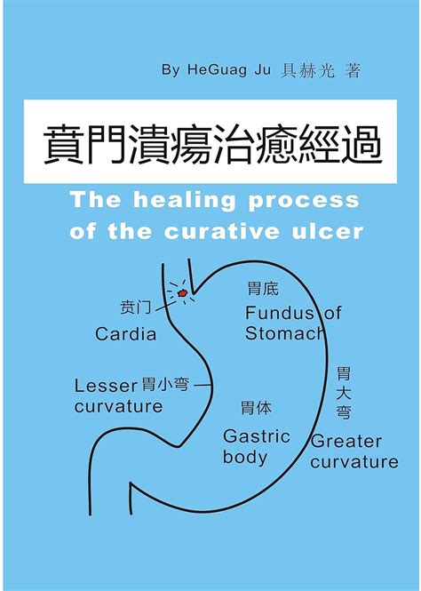 Cardia ulcer healing《賁門潰瘍治癒經過》: Recommended Reading for Patients with ...