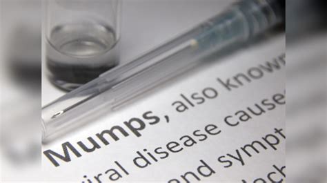 Early Symptoms Of Mumps: Swelling on the face could be mumps; early ...