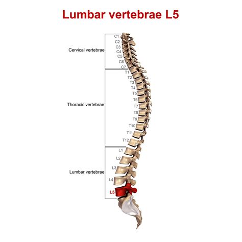 Treating an L5-S1 Disc Herniation: A Case Study - Regenexx