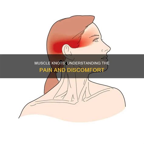 Muscle Knots: Understanding The Pain And Discomfort | CyVigor