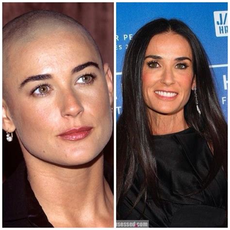 Demi Moore Plastic Surgery Face