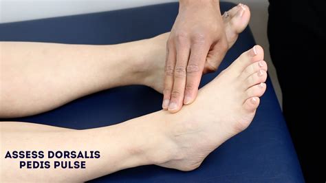 Foot Pulses Dorsalis Pedis at Tyler Curr blog
