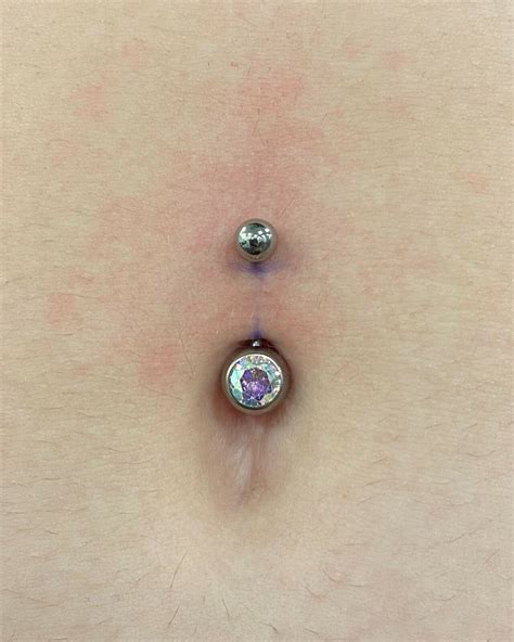 What To Do If You Get A Keloid On Your Belly Button Piercing at Landon Artis blog