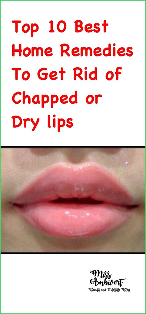 Top 5 Tips On How To | Dry lips, Chapped lips, Chapped lips remedy