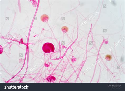 Rhizopus Stolonifer Microscope