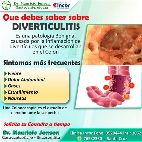 Diverticulitis En Español