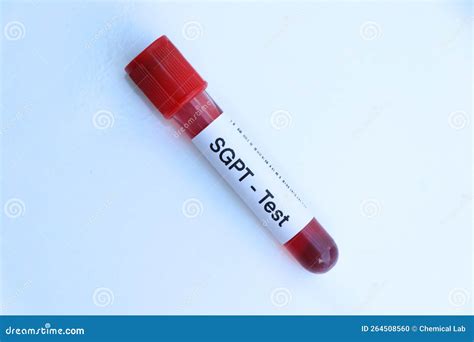 SGPT Test To Look for Abnormalities from Blood Stock Photo - Image of health, sample: 264508560