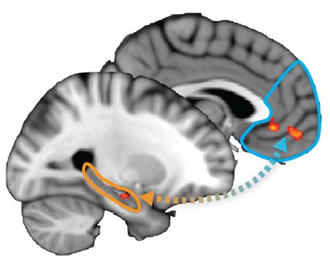 Brain Map Example 的图像结果