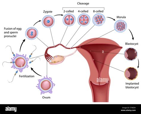 Implantation Diagram