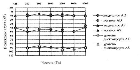 Международная классификация тугоухости